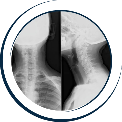 5 Components Of The Gonstead Technique - Chiropractor